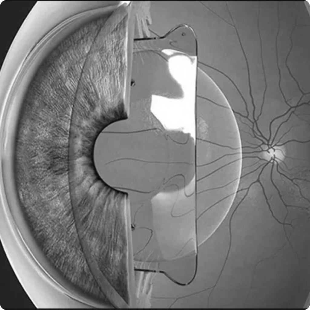 Home 4 2bw 1024x1024