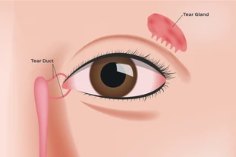 Surgery involving the lacrimal apparatus